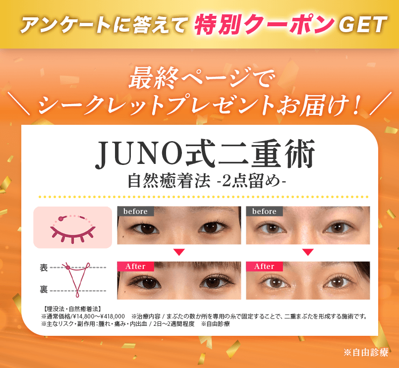 JUNO二重術 自然癒着法2点留め