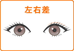 左右差